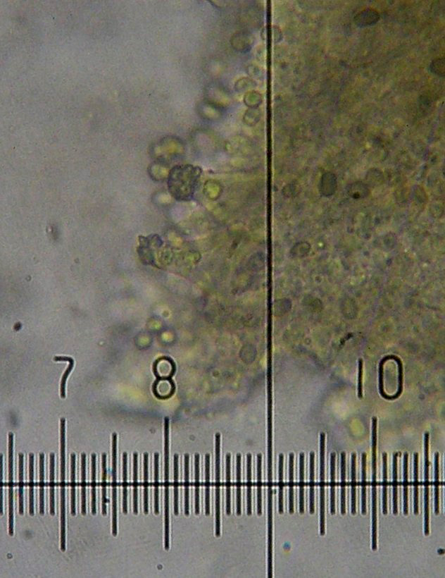 Метулоиды - цистиды, инкрустированные кристаллами.

Фото Юрия Абрамова. Автор фото: Получено по почте