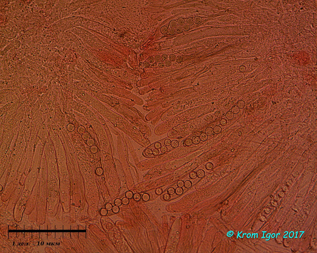 Строчевик круглоспоровый (Pseudorhizina sphaerospora)Сумки со спорами, парафизы Автор фото: Кром Игорь