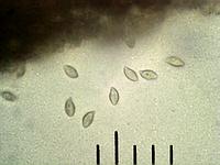 Размоченные в воде споры Ивишня (Clitopilus prunulus), х500; фото А.Е. Смирнова