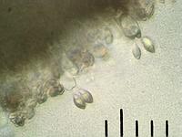 Ивишень (Clitopilus prunulus): базидии со спорами, х500, вода; Фото Смирнова А.
