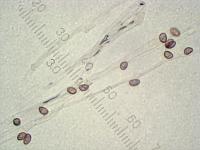 Паутинник камфарный (Cortinarius camphoratus): кортина гриба, х400, аммиак;  Фото Смирнова А.