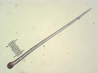 Паутинник камфарный (Cortinarius camphoratus): артефакт, найденный в споровом отпечатке, х100;  Фото Смирнова А.