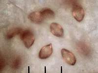 Рис. 3, а. Влияние малой глубины резкости оптического микроскопа на качество фотографии спор Cortinarius triumphans на листе белой бумаги: исходное изображение (фотография выполнена в отражённом пучке света). Фото Смирнова А