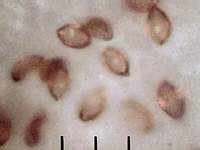 Рис. 3, б. Влияние малой глубины резкости оптического микроскопа на качество фотографии спор Cortinarius triumphans на листе белой бумаги: исходное изображение (фотография выполнена в отражённом пучке света). Фото Смирнова А