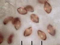 Рис. 3, в. Влияние малой глубины резкости оптического микроскопа на качество фотографии спор Cortinarius triumphans на листе белой бумаги: результирующее изображение (фотография выполнена в отражённом пучке света). Фото Смирнова А