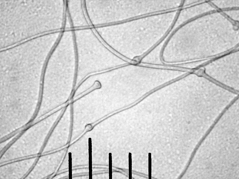 гифы клейкой мицелиальной нити, х500 Автор фото: Андрей Смирнов