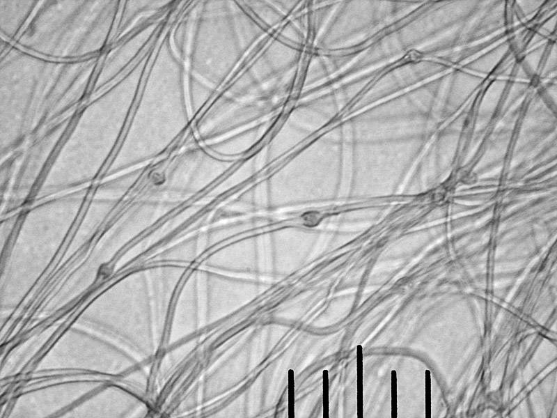 гифы клейкой мицелиальной нити, х400 Автор фото: Андрей Смирнов