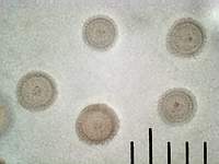 Трюфель олений (Elaphomyces granulatus): споры, х500, аммиак; фото А.E.Смирнова