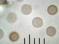 Трюфель олений (Elaphomyces granulatus): споры, х500, аммиак; фото А.E.Смирнова