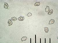 Энтолома шершавоножковая (Entoloma hirtipes) споры, х500, аммиак; фото А.E.Смирнова