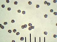 Энтолома оловянная (Entoloma sinuatum): сухие споры, х500; Фото Андрея Смирнова