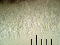 Грифола курчавая (Grifola frondosa): стерильный наружный слой гриба, х500. Фото Смирнова А.