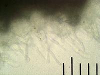 Грифола курчавая (Grifola frondosa): стерильный наружный слой гриба, х500. Фото Смирнова А.