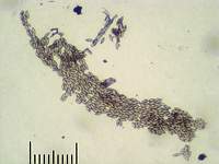 Грабовик (Leccinum carpini): сухие споры, х125; Фото Смирнова А.Е.