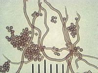 Мириостома шейковидная (Myriostoma_coliforme): гладкие нити капиллиция и споры, х400, аммиак; Фото Смирнова А.