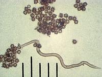 Мириостома шейковидная (Myriostoma_coliforme): гладкие нити капиллиция и споры, х500, аммиак; Фото Смирнова А.