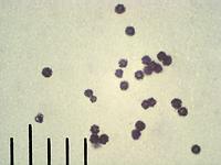 Мириостома шейковидная (Myriostoma_coliforme): сухие споры, х500; Фото Смирнова А.