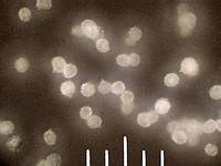 Рис. 5. Споры Russula foetens на покровном стекле в отражённом пучке света. Фото Смирнова А