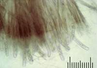 Sarcosoma globosum: сумки с несозревшими спорами, х125; фото А.E.Смирнова