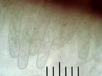 Sarcosoma globosum: сумки с несозревшими спорами, х400; фото А.E.Смирнова
