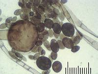 Sporangium with spores x125; фото Андрея Смирнова