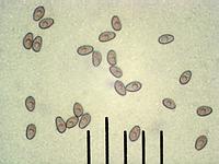 Строфария корончатая (Stropharia coronilla): споры, х500, аммиак; Фото Смирнова А.