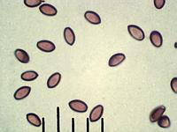 Строфария полушаровидная (Stropharia semiglobata): споры х500; фото А.Е.Смирнова