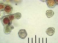 Специализированные клетки трентеполии, которые используются для размножения; фото Андрея Смирнова