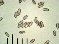 Моховик трещиноватый (Xerocomus chrysenteron): сухие споры, х500; Фото Смирнова А.Е.