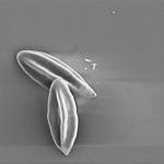 Споры Ивишня (Clitopilus prunulus), х25460; фото А.Е. Смирнова