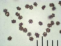 Сухие споры Волоконницы звёздчато-споровой (Inocybe asterospora), х500; фото А.Е. Смирнова