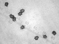 Размоченные в аммиаке споры Волоконницы звёздчато-споровой (Inocybe asterospora), х500; фото А.Е. Смирнова