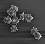 Споры Волоконницы звёздчато-споровой (Inocybe asterospora), х13020; фото А.Е. Смирнова