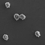 Споры Млечника жгуче-млечного (Lactarius pyrogalus), х12660; фото А.Е. Смирнова