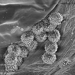 Споры неопознанной жёлтой сыроежки на тельце грибного клеща Pygmephorous, х10140; фото А.Е. Смирнова