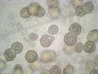 Сепедониум золотистоспоровый (Sepedonium chrysospermum), алевриоспоры (округлые) и бластоконидии (вытянутые), x500; фото Андрея Смирнова