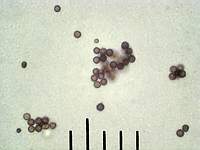 Звездовик черноголовый (Geastrum melanocephalum): споры, х500, аммиак; фото А.E.Смирнова