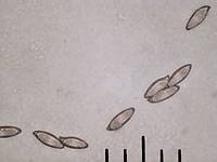 Споры Leccinum scabrum var. scabrum. Увеличение х500; фото А.Е.Смирнова