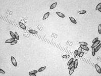 Сухие споры Подосиновика красного (Leccinum aurantiacum), х500; фото А.Е. Смирнова