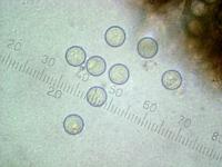 Размоченные в воде споры Псевдоплектании черноватой (Pseudoplectania nigrella), х500; фото А.Е. Смирнова